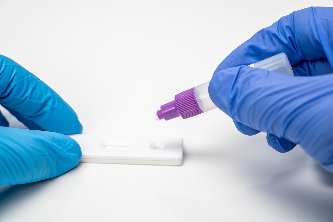 corona, coronavirus, covid, laboratory, medical, lab, health, laboratory, laboratory, lab, lab, lab, lab, lab