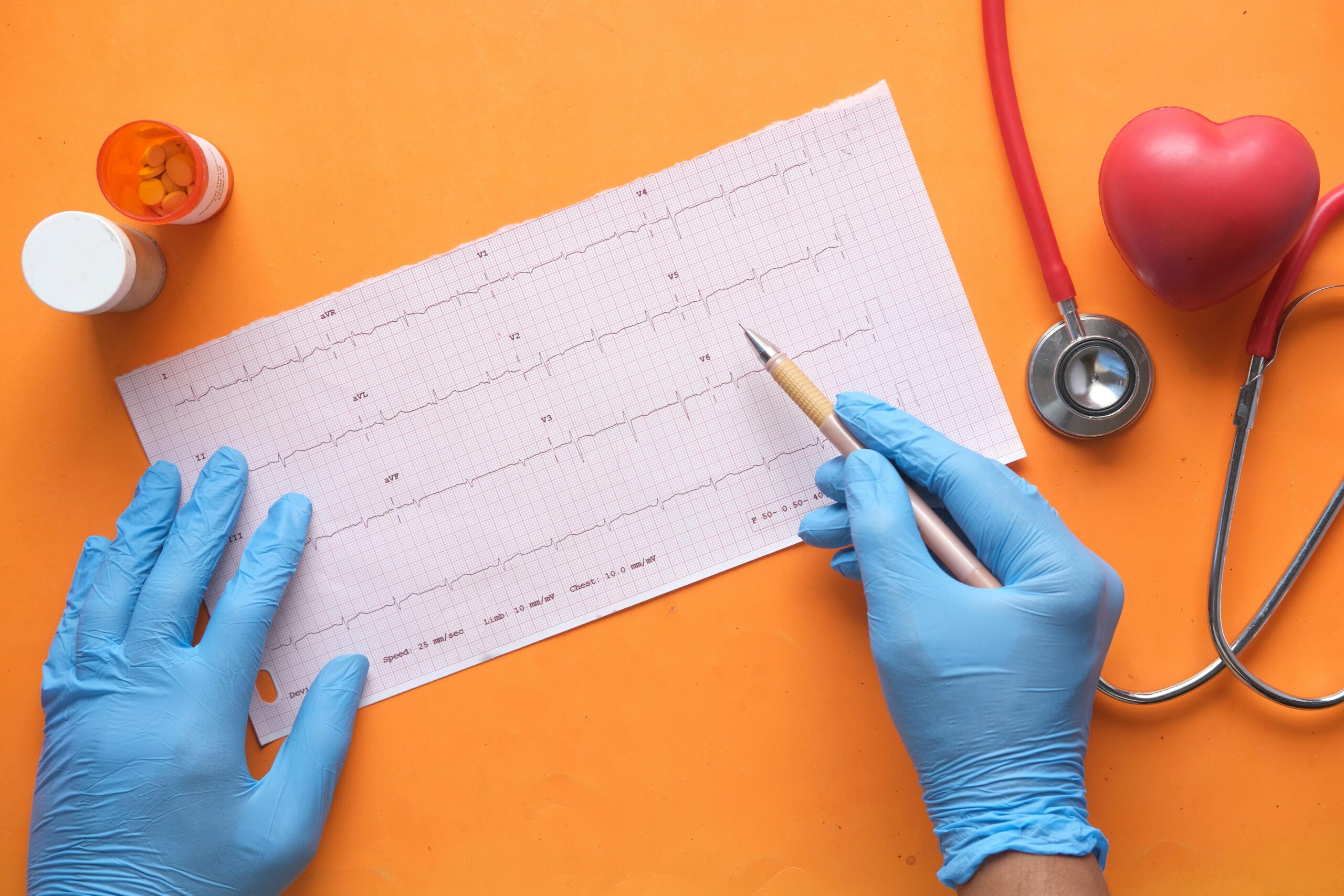 Hands with gloves analyzing an electrocardiogram on an orange background with stethoscope and pills.